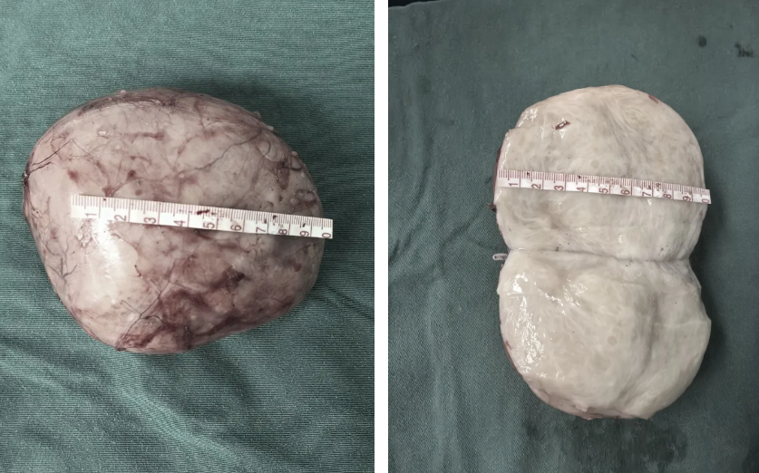 ERAS 点燃希望,为学子打通"健康赶考路"!