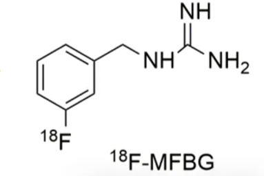 【硬「核」科普】¹⁸F-MFBG PET/CT 赋能晕厥与神经系统疾病精准诊疗