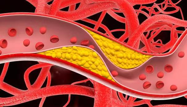 警惕！这个威胁年轻人的第一健康「杀手」，正藏在你的生活里