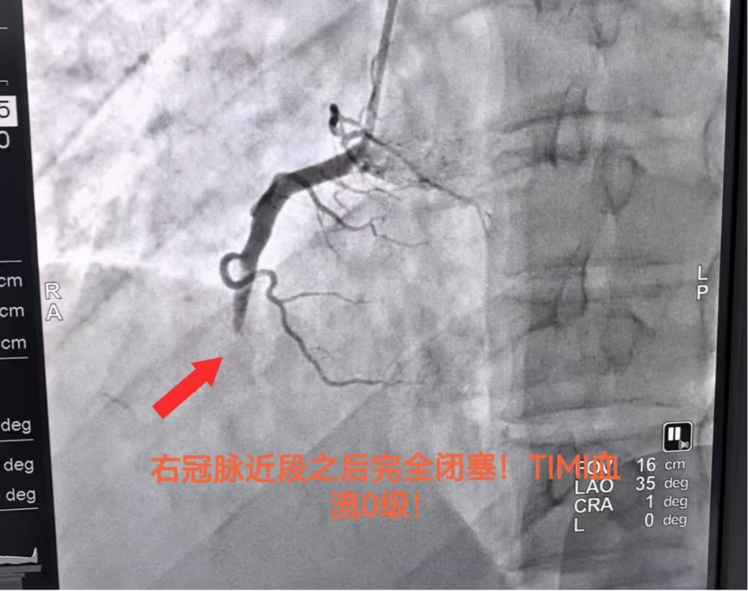 警惕！这个威胁年轻人的第一健康「杀手」，正藏在你的生活里