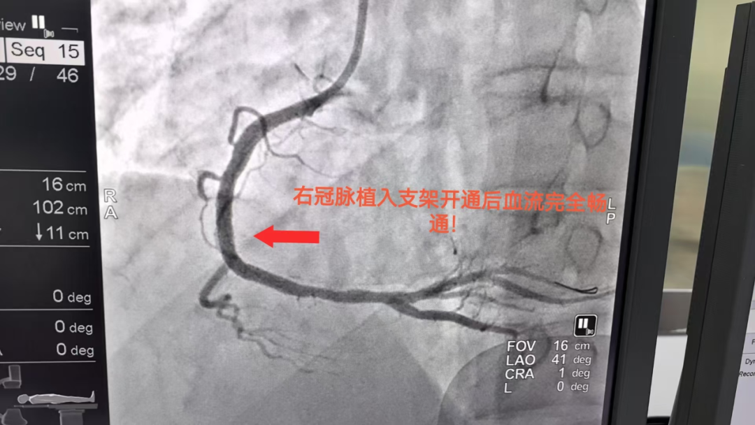 警惕！这个威胁年轻人的第一健康「杀手」，正藏在你的生活里