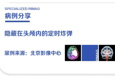 典型病例 | 隐藏在头颅内的定时炸弹