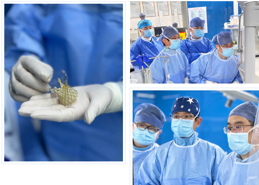 湖州市中心医院心脏瓣膜团队单日完成 3 例高难度手术