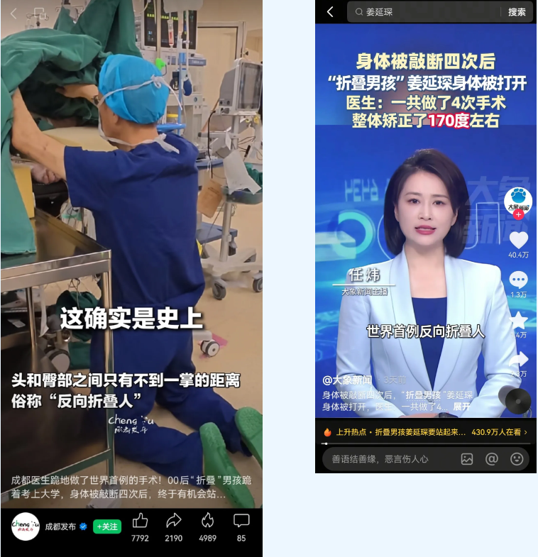 全网播放量数亿！成都京东方医院完成世界首例反向折叠人矫正手术