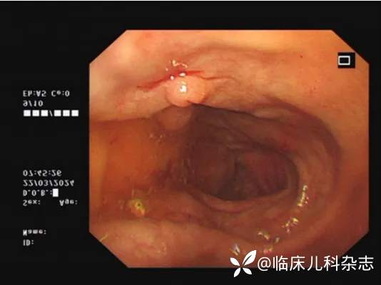 火眼辨症·第 7 期丨女童腹痛反复发作，怎么诊治？