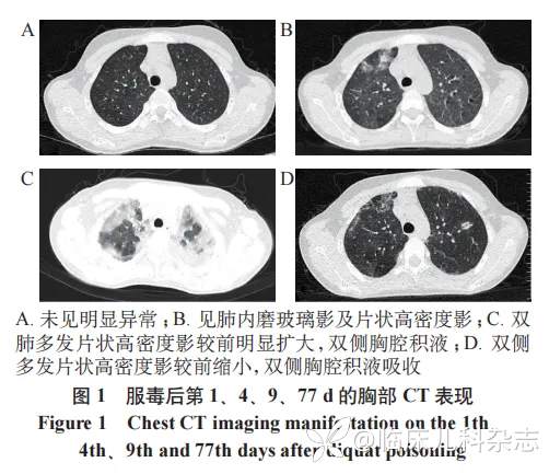 儿童敌草快中毒 8 例临床分析并文献复习