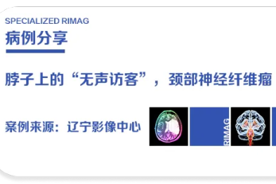 典型病例 | 脖子上的 「无声访客」 到底怎么回事？