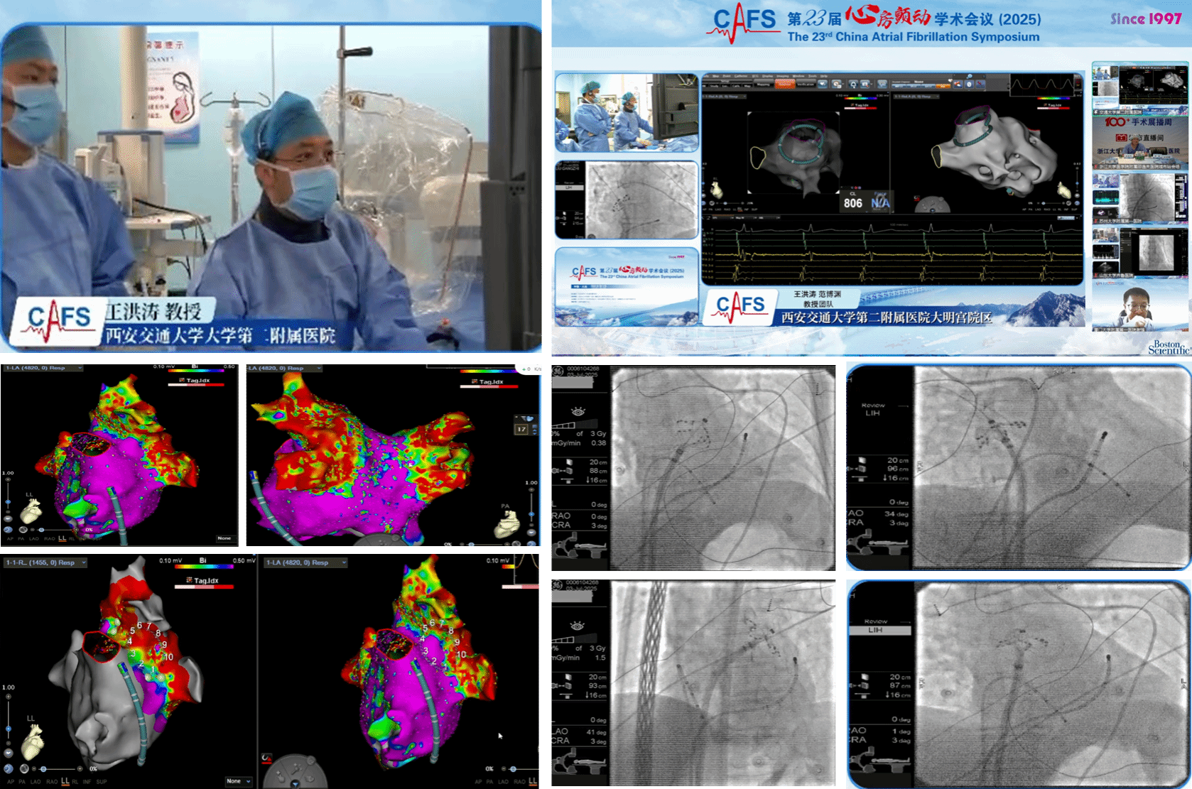 西安交大二附院心内科闪耀全国房颤舞台