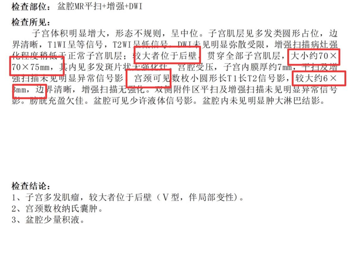 月经异常半年，腹部如 4 月孕肚，竟剥出 45 颗子宫肌瘤！