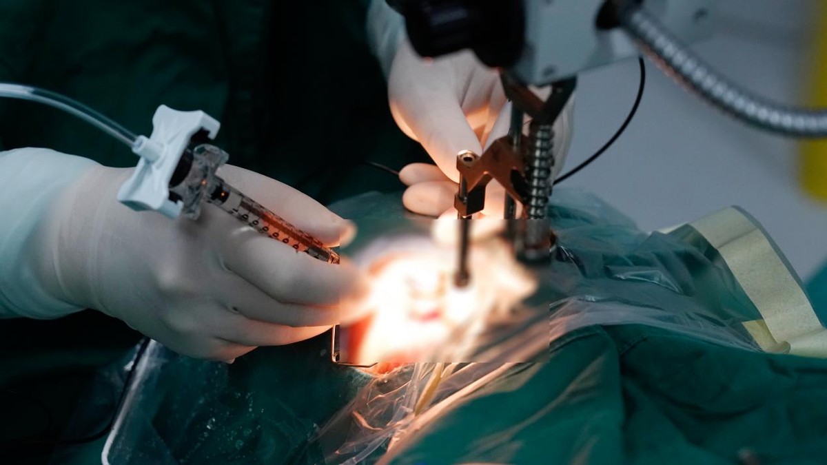 成都爱尔眼科完成超微创 t-PA 注射术，助七旬黄斑变性患者重见光明