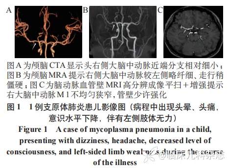 儿童动脉缺血性脑卒中临床特征分析:一项单中心回顾性研究