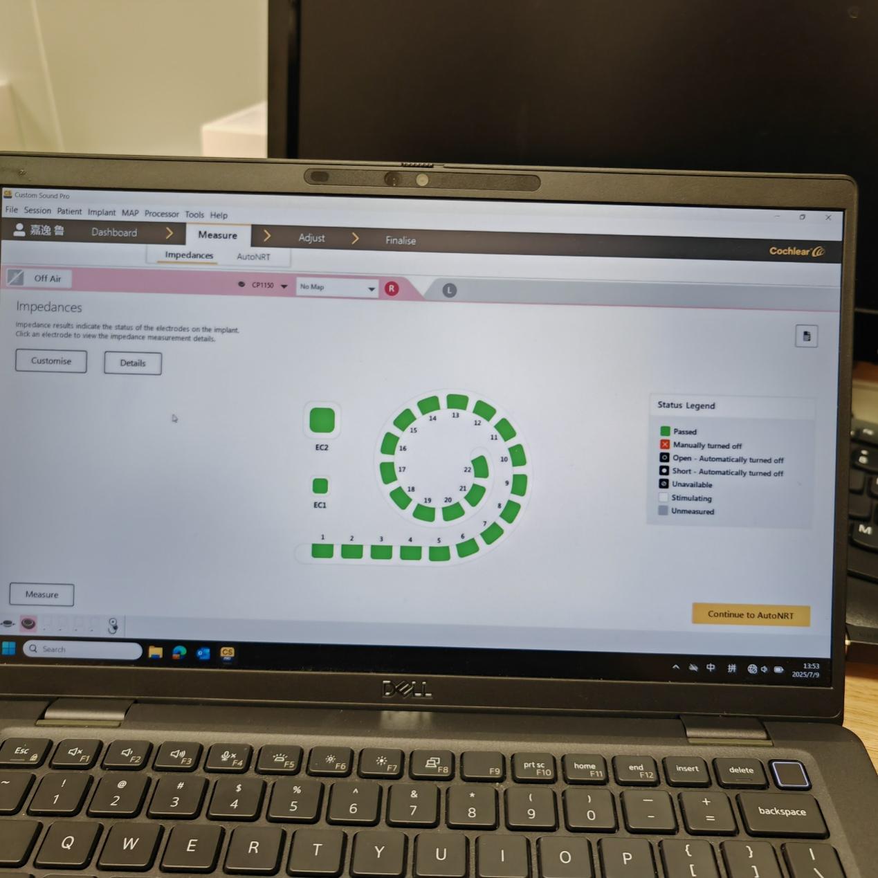 凉山男孩听见世界的第一天:技术和政策帮他打开「声音大门」