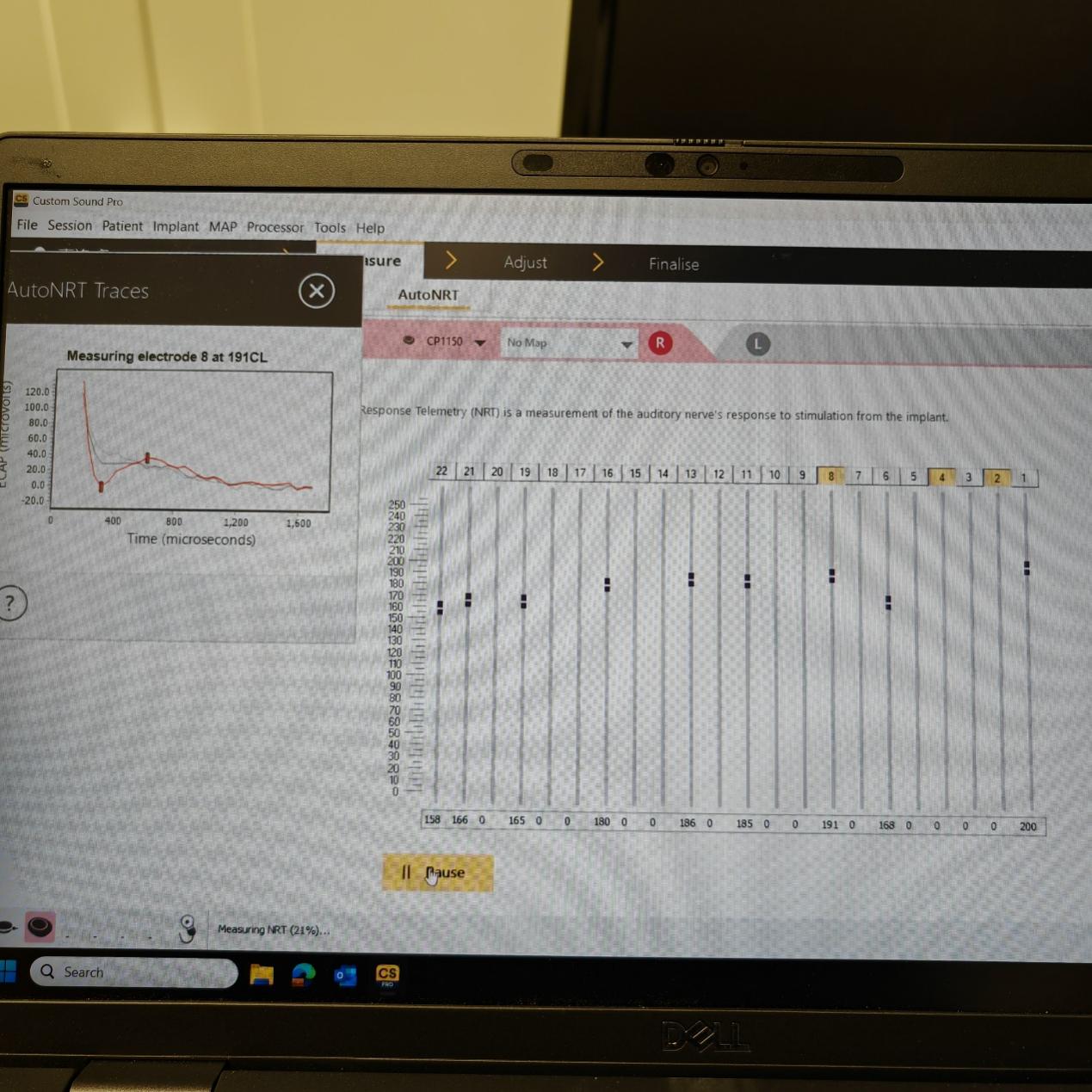 凉山男孩听见世界的第一天:技术和政策帮他打开「声音大门」