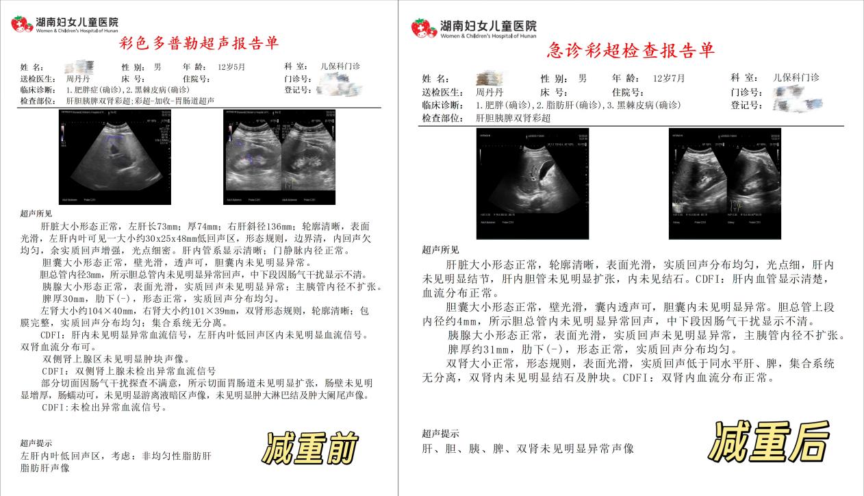12.5 岁男孩体重高达 180 斤，多项指标亮红灯！