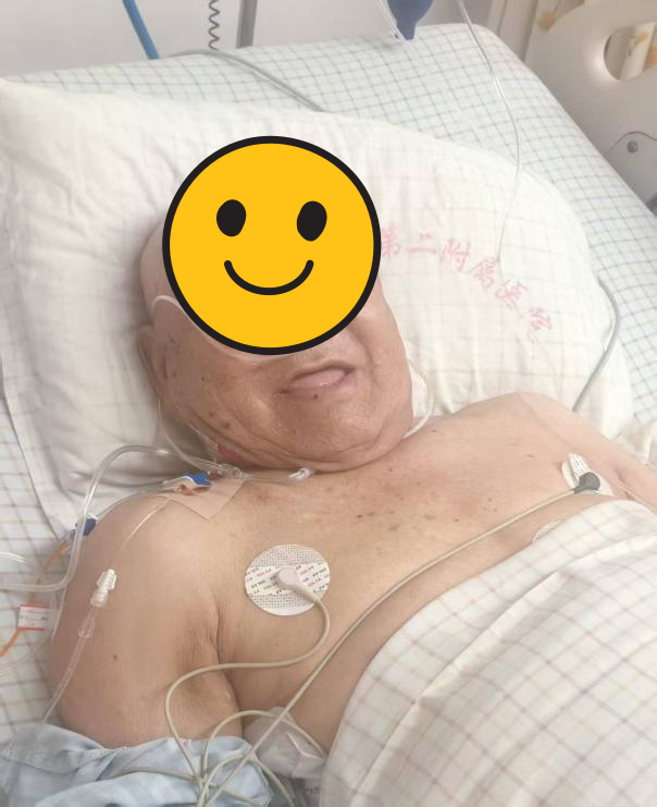 肺癌中晚期+转移≠绝望，桂医二附院一套「组合拳」让癌症变慢病