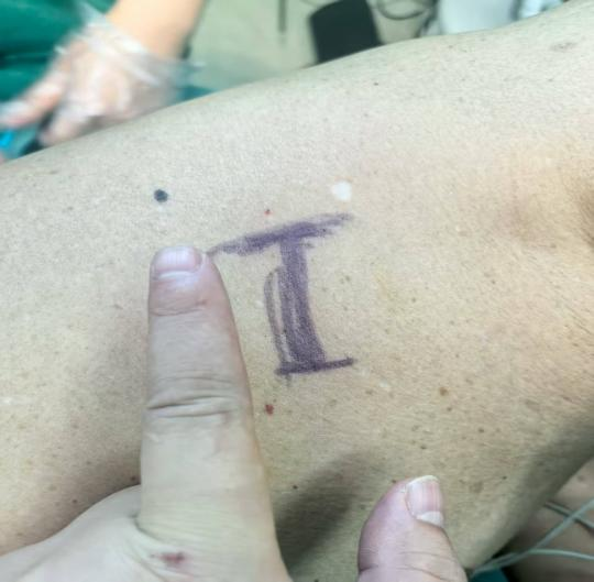 肺癌中晚期+转移≠绝望，桂医二附院一套「组合拳」让癌症变慢病