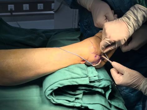 苏州明基医院骨科中心关节与运动医学科微创技术全覆盖：四大关节疑难杂症，「钥匙孔」内精准破解