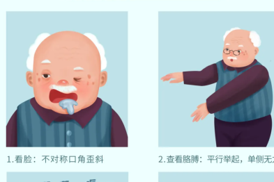夏季高温桑拿天，防中暑更要警惕「热中风」！