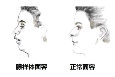 张口呼吸毁颜值？这个像桔子的器官在悄悄搞事情！