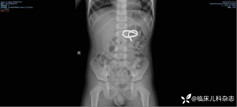 1-3 岁儿童成高危人群，这些「致命凶器」就在孩子身边