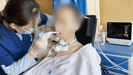 做了气切可以经口喂食吗？吞咽训练帮您解决「吃」的难题