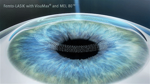 大学生暑期摘镜全攻略!