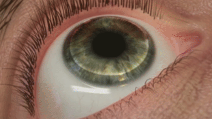 大学生暑期摘镜全攻略!