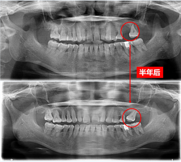 人老不该先掉牙，别让健康从「齿」溜走