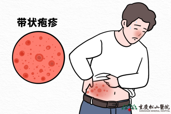 带状疱疹疫苗怎么打?检测流程一文说清