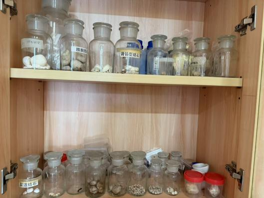 一方水土养一方结石? 结石成分藏玄机~