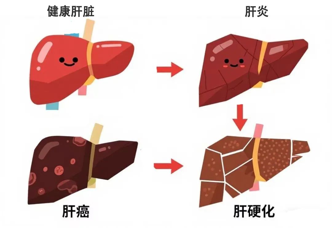 合肥京东方医院科普:多年乙肝,真能「治愈」吗?这些患者更易「摘帽」!