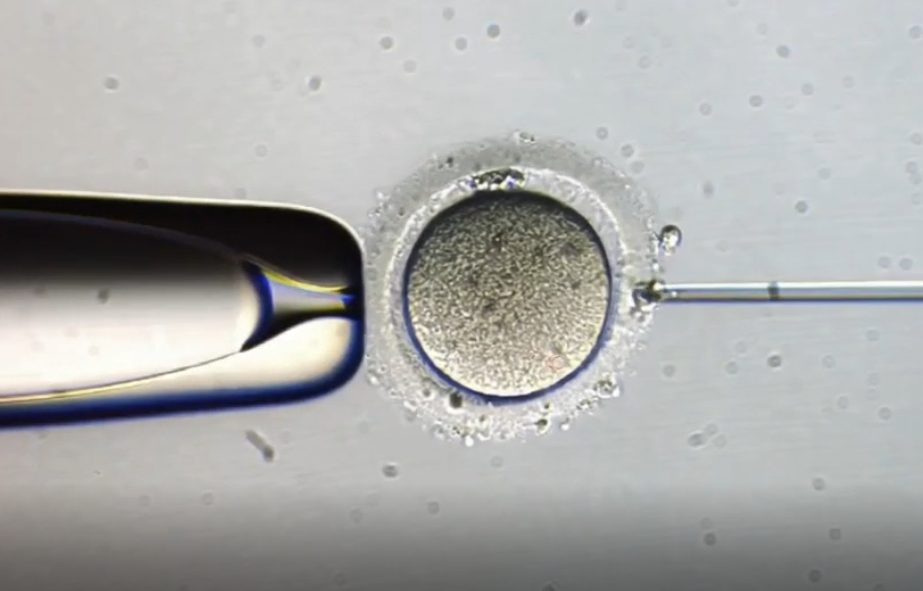 武汉大学人民医院生殖医学团队利用「卵母细胞人工激活术」成功助孕