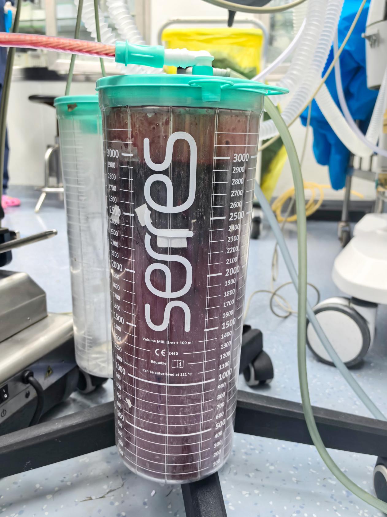 孕妇产前大出血!南医大二附院多学科联合抢救!