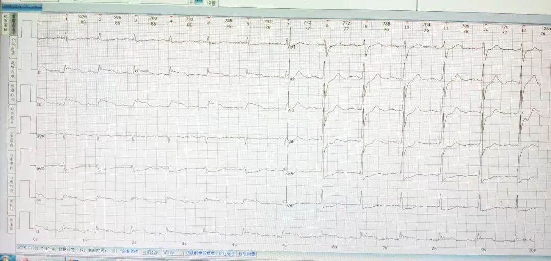 26 分钟极速开通血管！他们是如何做到的？