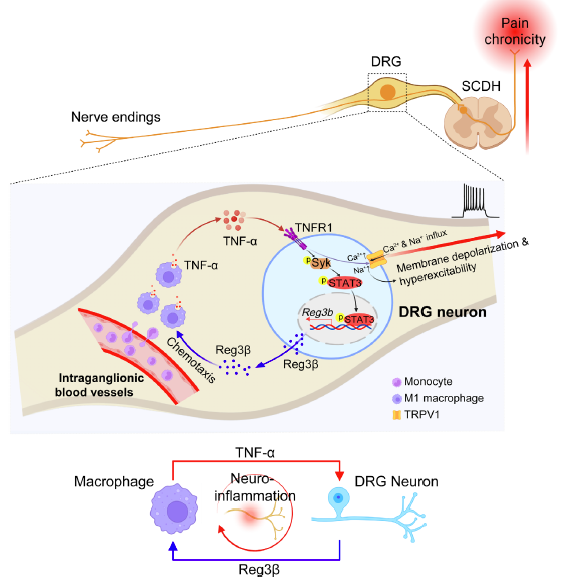浙中医大三院方剑乔/刘伯一研究团队在慢性痛及针刺镇痛机制研究取得重要进展