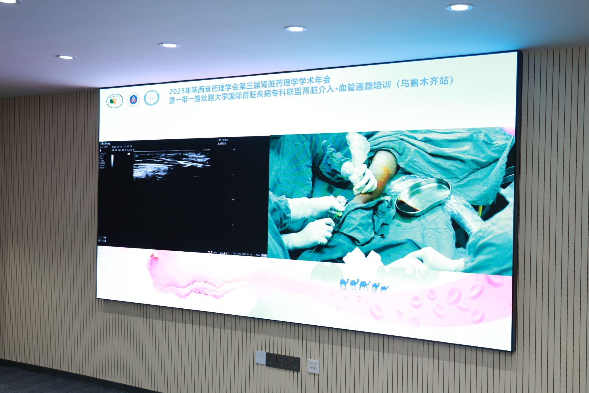 丝路携手共筑健康通路——肾脏介入・血管通路培训圆满落幕