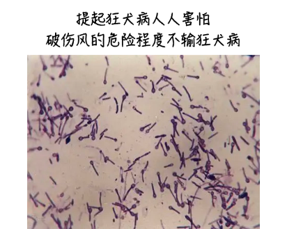 不及时处理致死率近 100%！这种「小伤」不能大意