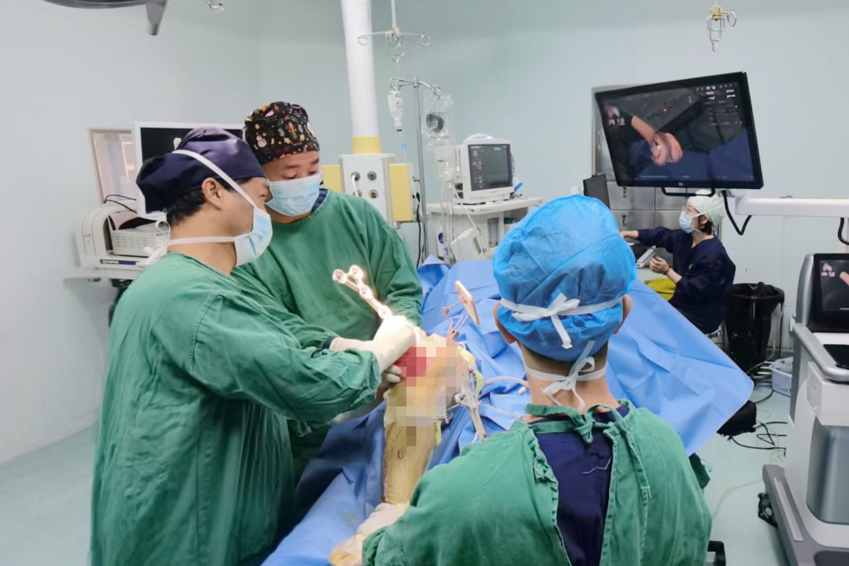 南医大二附院首例！机器人辅助全膝关节置换术！