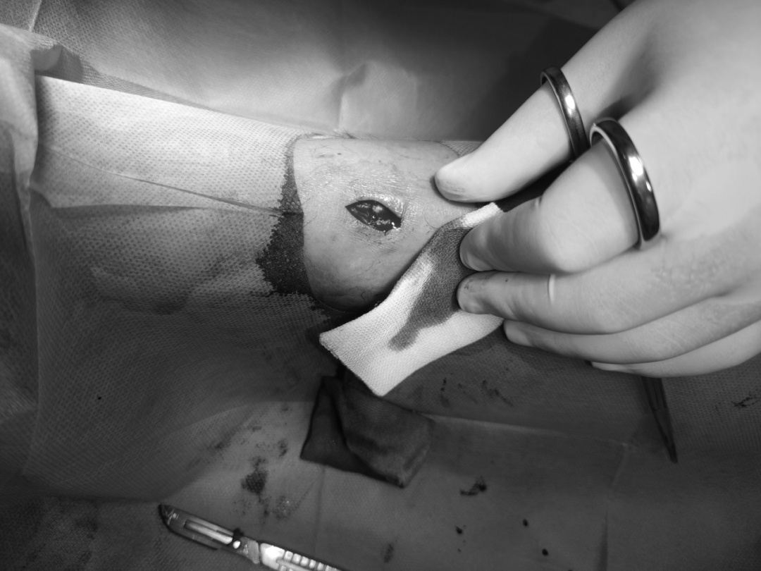 不及时处理致死率近 100%！这种「小伤」不能大意