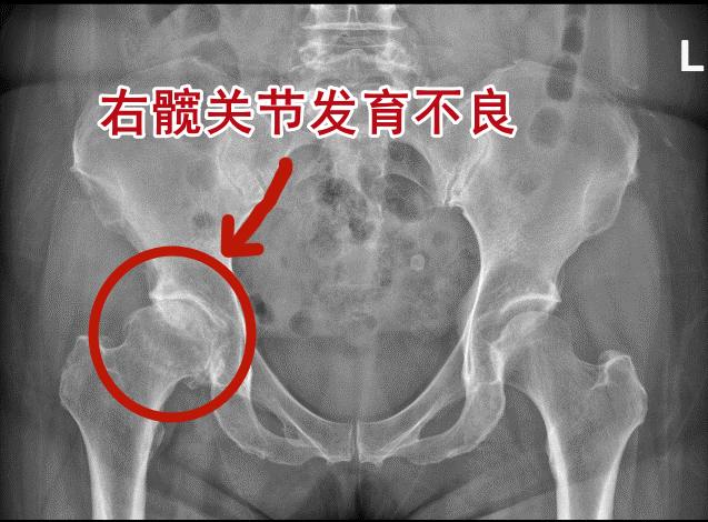 被误诊 7 年,饱受痛苦... 权威专家出手揪出「真凶」