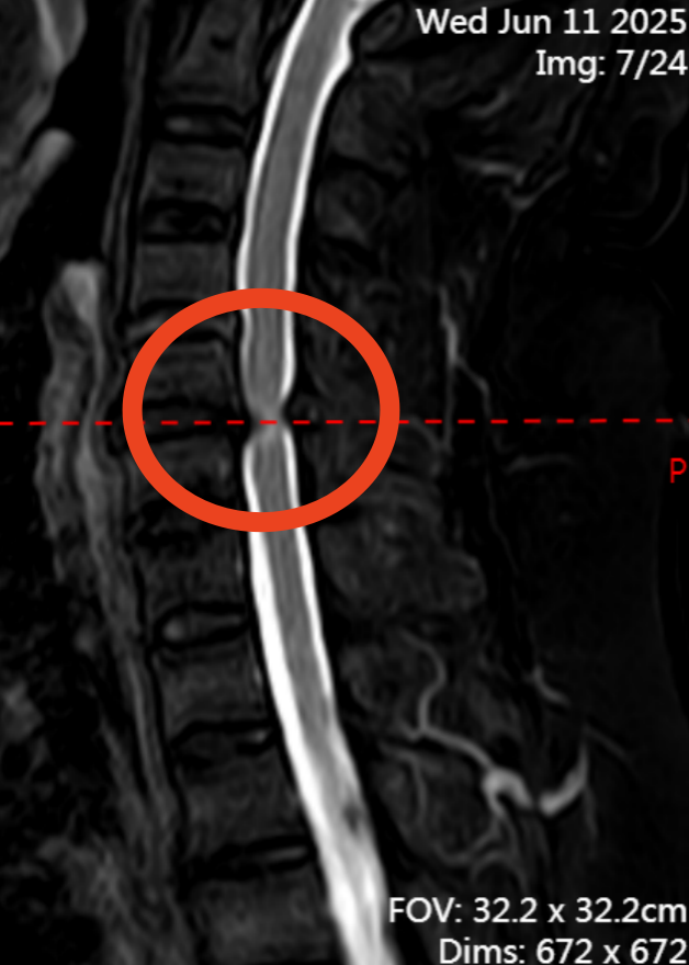 脊柱外科技术巡展：用技术与温情筑牢 「人体支柱」 的健康防线