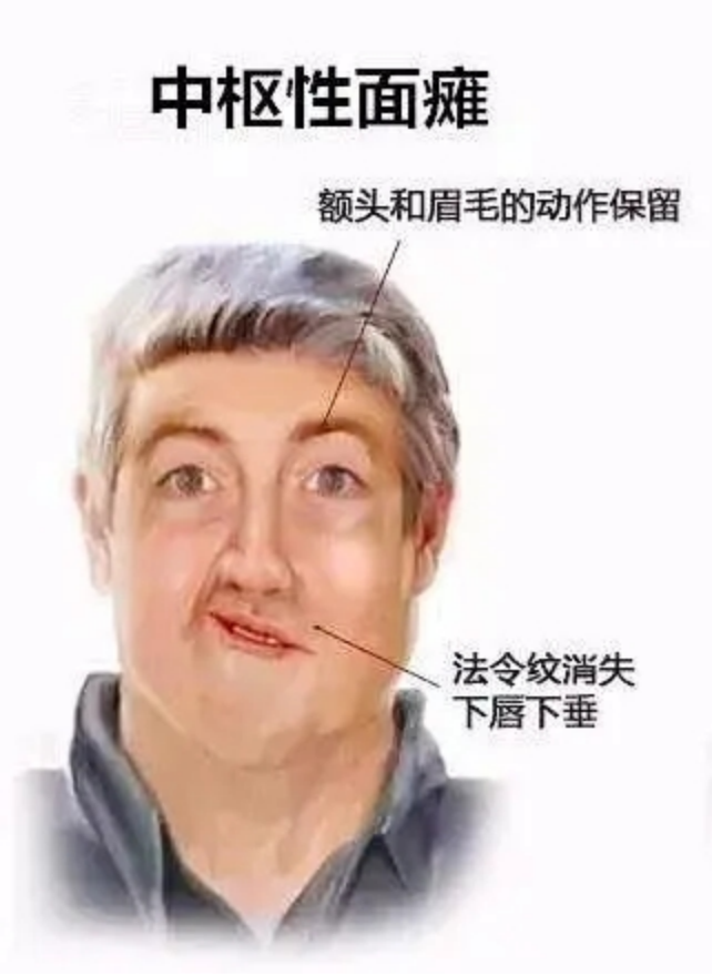 脸歪到破大防，大小脸怎么办……关键问题就在这里！