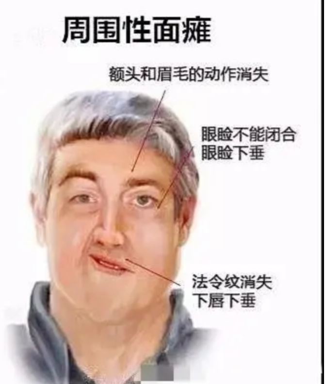 脸歪到破大防，大小脸怎么办……关键问题就在这里！