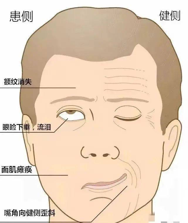 脸歪到破大防，大小脸怎么办……关键问题就在这里！