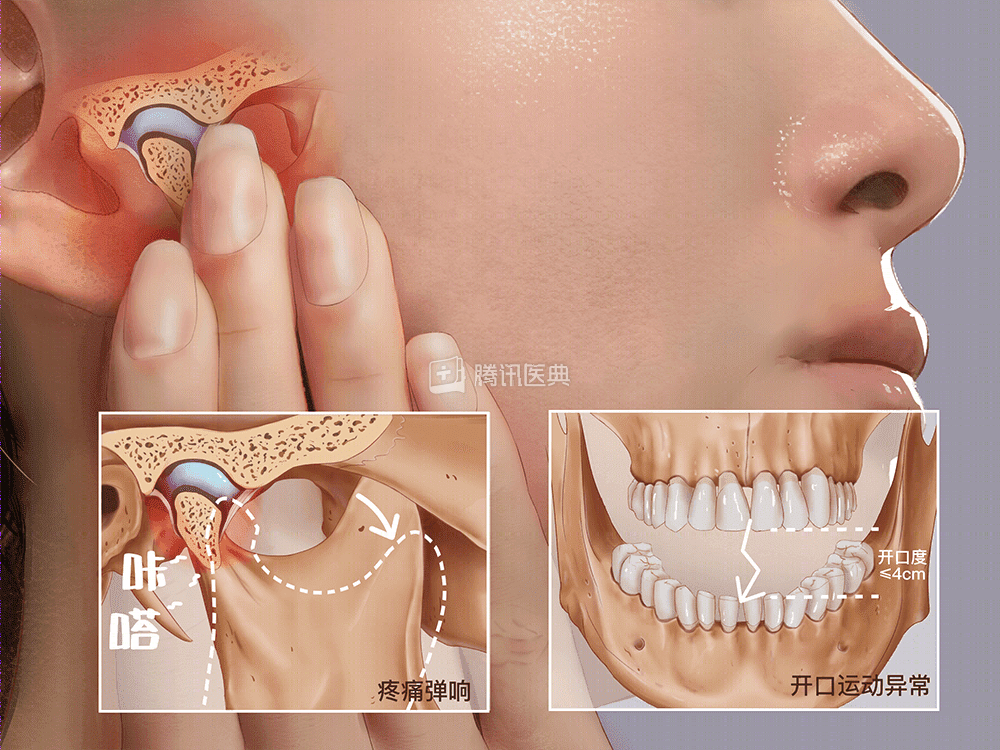 脸歪到破大防，大小脸怎么办……关键问题就在这里！