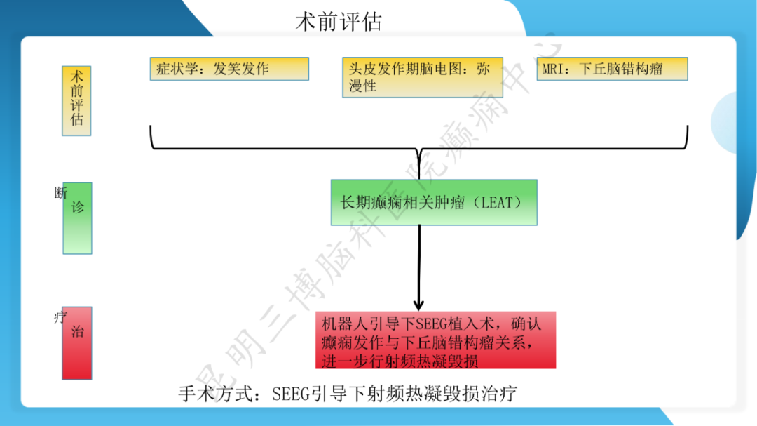 「痫停」信步》癫痫治疗病例荟萃第二十六期---SEEG 引导下射频热凝毁损治疗下丘脑错构瘤所致发笑癫痫