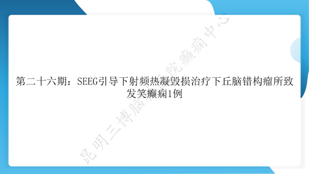 「痫停」信步》癫痫治疗病例荟萃第二十六期---SEEG 引导下射频热凝毁损治疗下丘脑错构瘤所致发笑癫痫