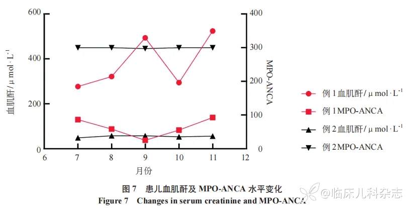 儿童共患 ANCA 相关性血管炎肾损害双胞胎一对报告