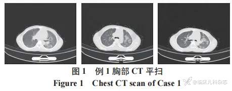 儿童共患 ANCA 相关性血管炎肾损害双胞胎一对报告