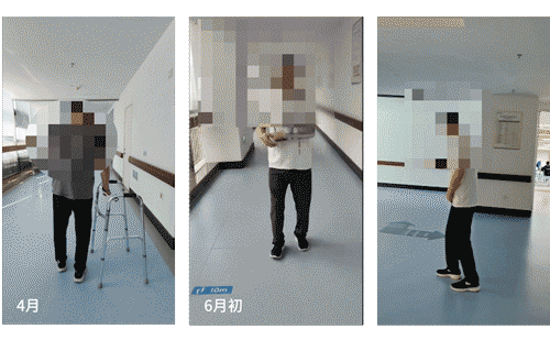 错练 8 个月坐轮椅？科学康复让他重获行走自由 —— 偏瘫康复避坑指南